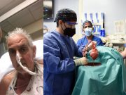 First pig heart transplant patient, died two months later