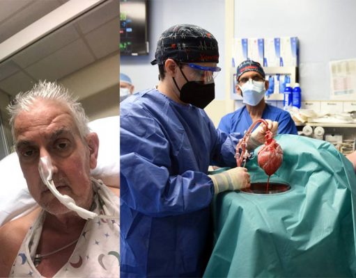 First pig heart transplant patient, died two months later