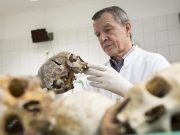 German Forensic Doctor Claims: No COVID-19 Death in Hamburg