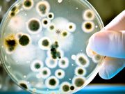 What if Germs and Viruses do not Cause Disease?