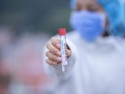 Scientific Problem with COVID-19 RT-PCR Testing