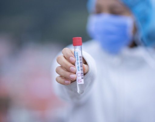 Scientific Problem with COVID-19 RT-PCR Testing